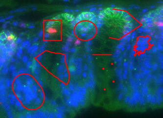 annotations of different types